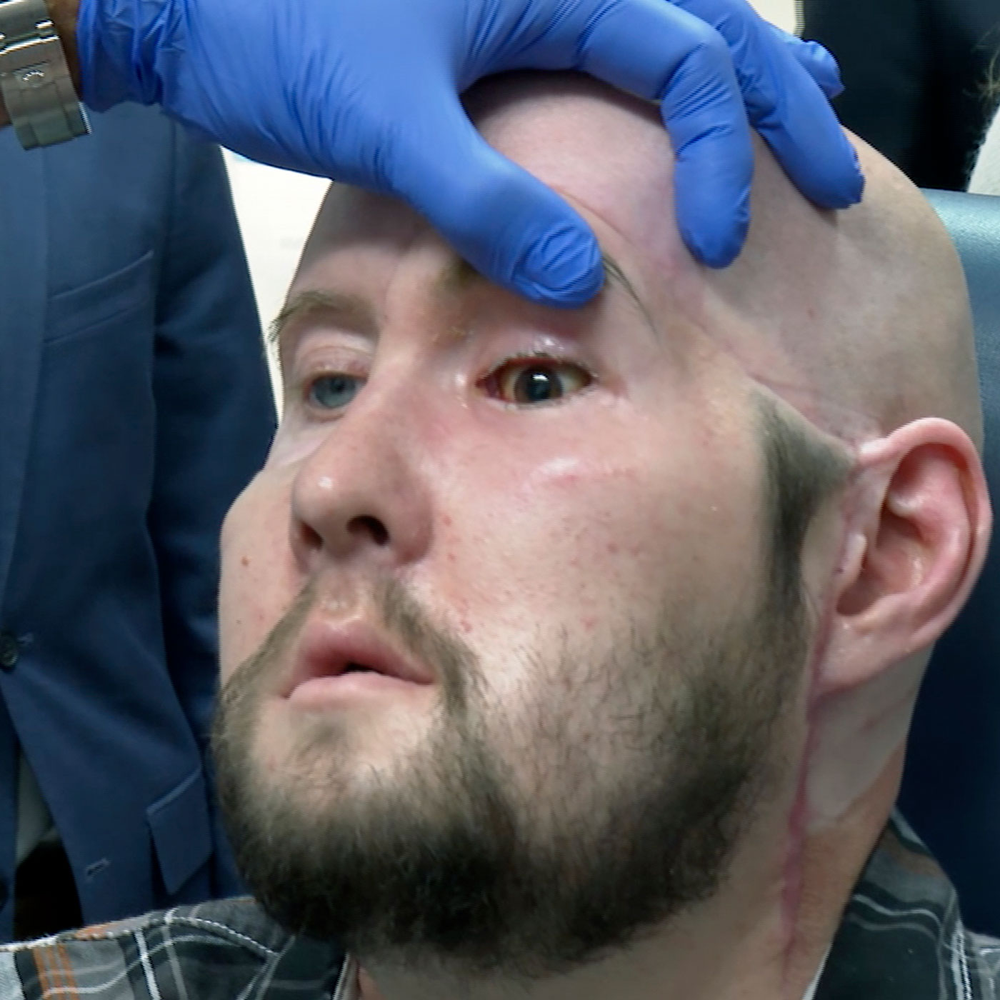 Augentransplantation - Wie realistisch ist das?