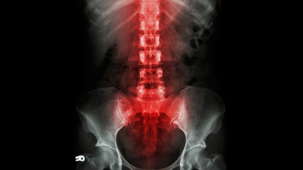 Kaufe Iliosakral-SI-Gelenkschmerzen, Becken, unterer Rücken, Unterstützung,  Lendenwirbelsäule, Hüftgurt, Damen und Herren, 1 Stück